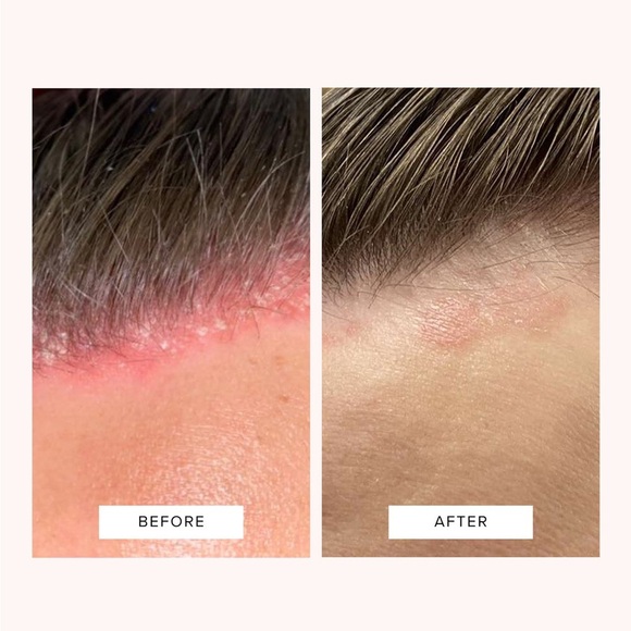 MONPURE HYDRATE AND
SOOTHE SCALP SERUM - Picture 10 of 11